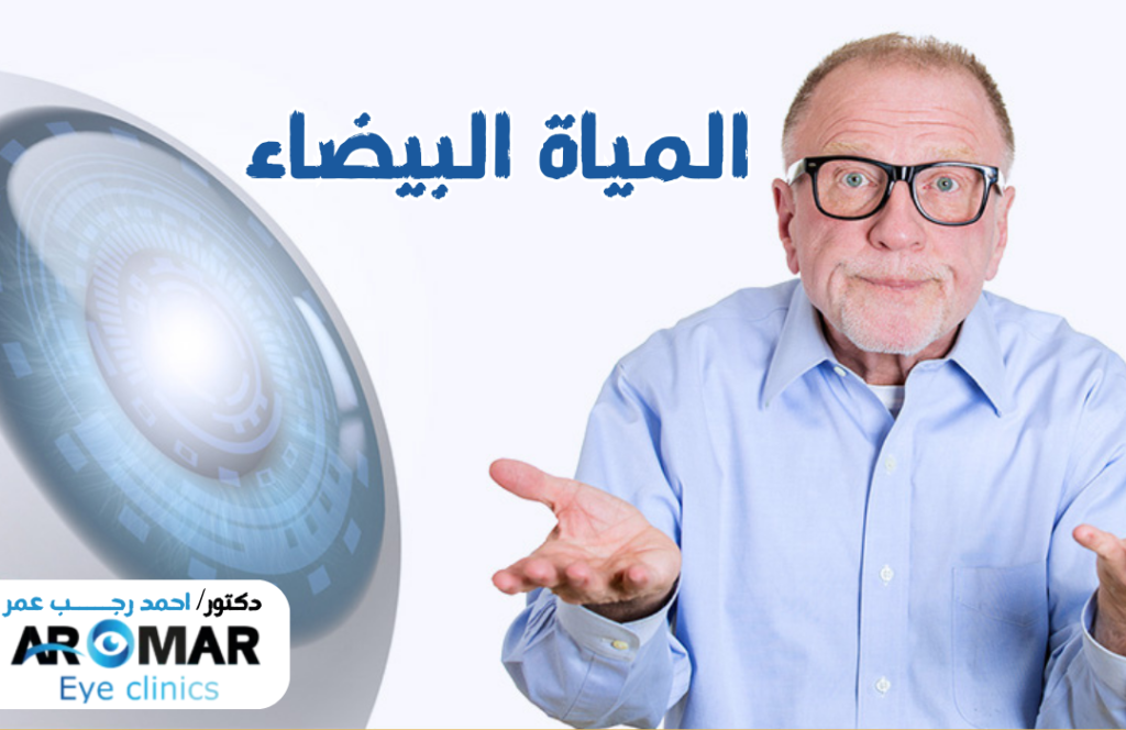 المياة البيضاء - طرق علاجها - أنواع العدسات